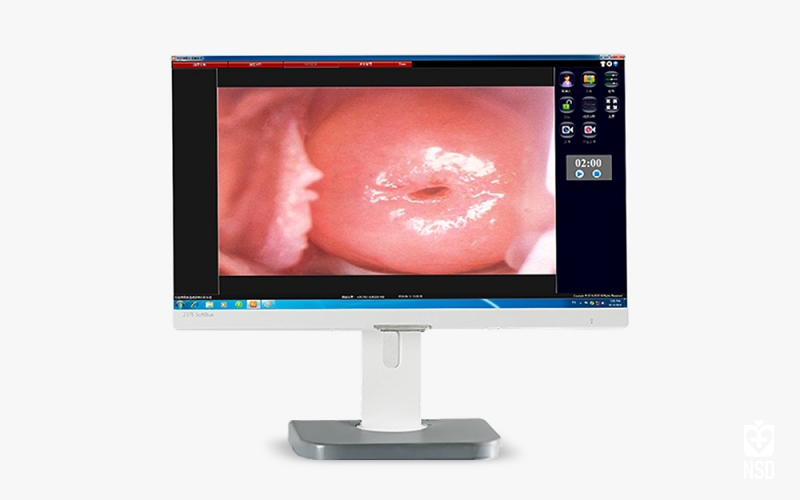 Optical Colposcope KN-2200 BI